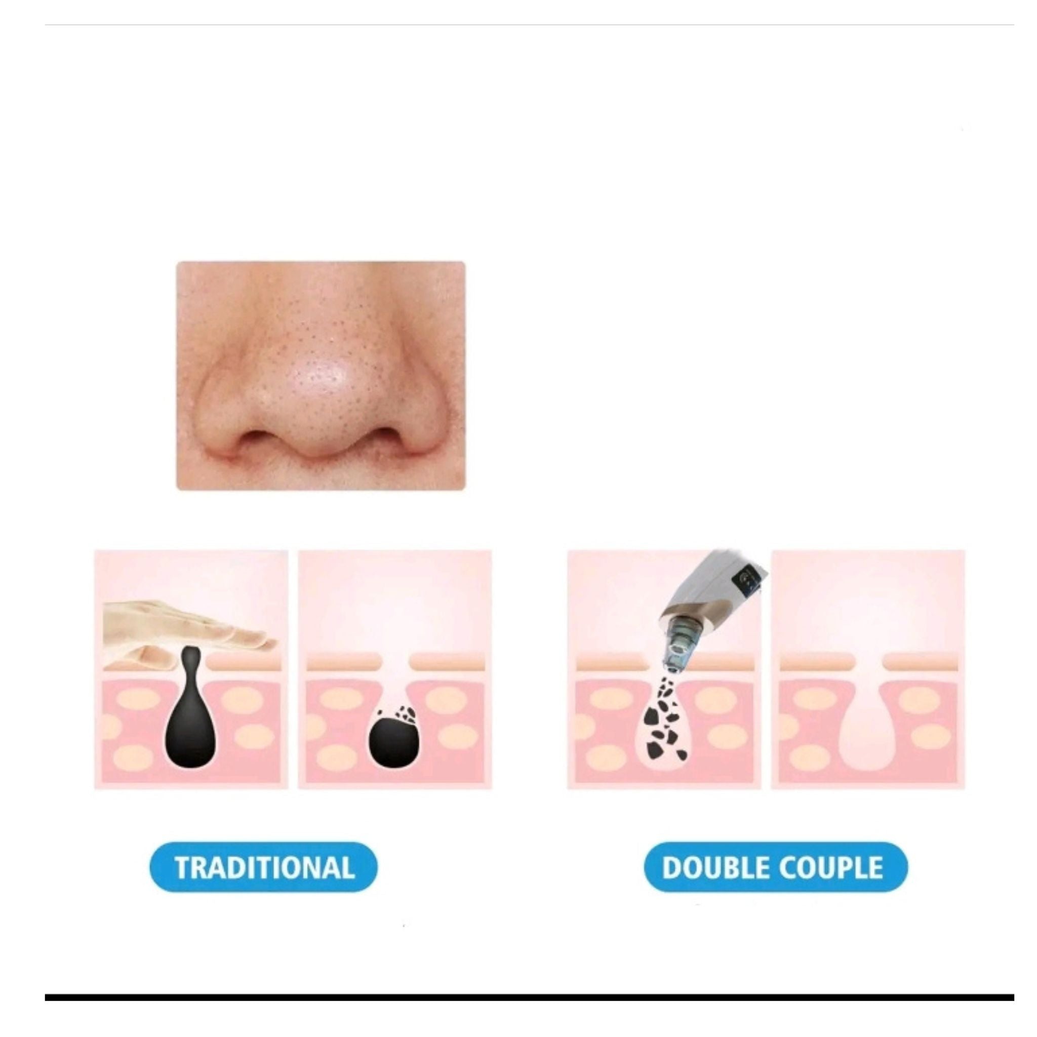 Face Vacuum Suction Blackhead Remover Pore Cleaner | Electric Deep Cleansing Tool for Nose & Face