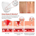 DermaSmooth Skin Tag Remover Patches | Fast & Painless Removal