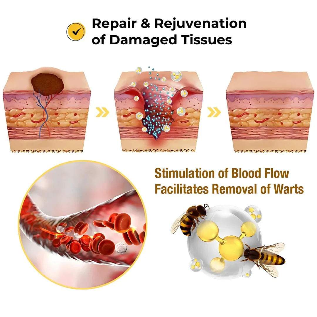 DermaSmooth Skin Tag Remover Patches – Fast, Safe, Painless Removal for Skin Tags and Moles with No Scars or Discoloration