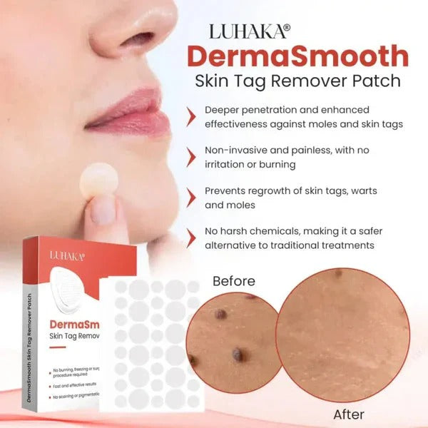 DermaSmooth Skin Tag Remover Patches – Fast, Safe, Painless Removal for Skin Tags and Moles with No Scars or Discoloration