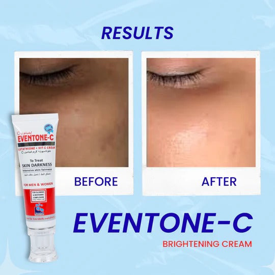 Eventone-C Glutathione Skin Brightening Cream