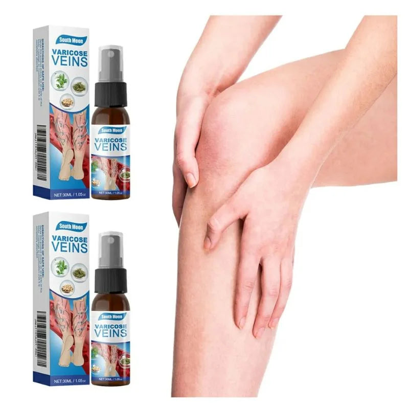 Varicose veins treatment spray and packaging with a hand touching a leg.