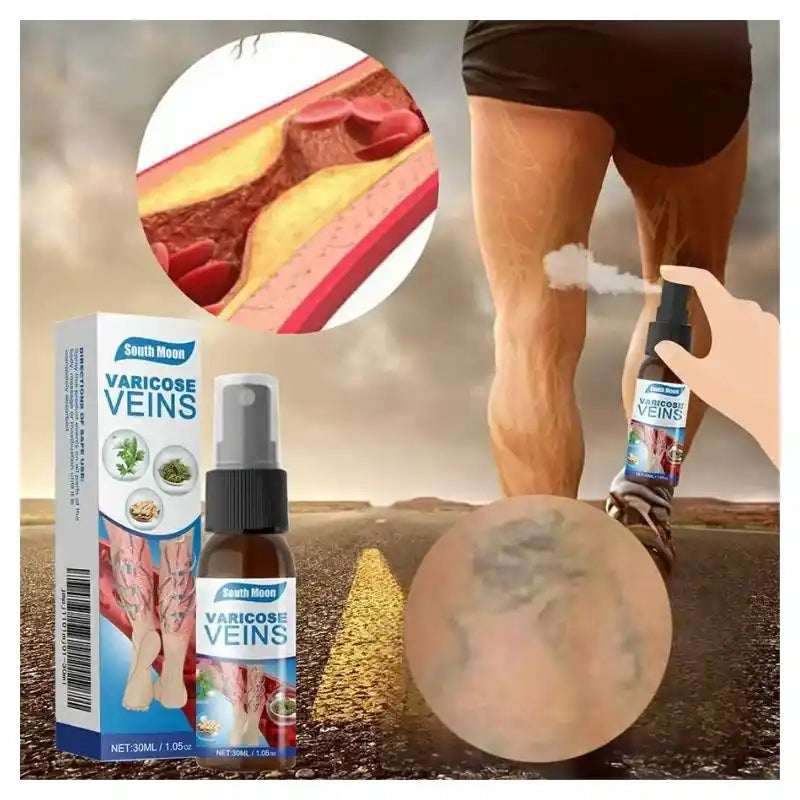 Varicose veins treatment spray with packaging and close-up of legs and veins.